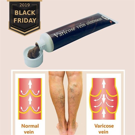 Health-Care Cream-Effective Veins-Treatment Varicose Cure Spider-Veins Pain Vasculitis